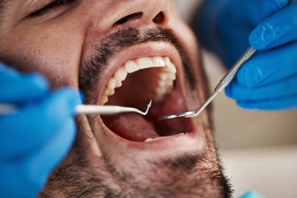 Best Broken or Cracked Tooth Emergency Dentist in Duson, LA